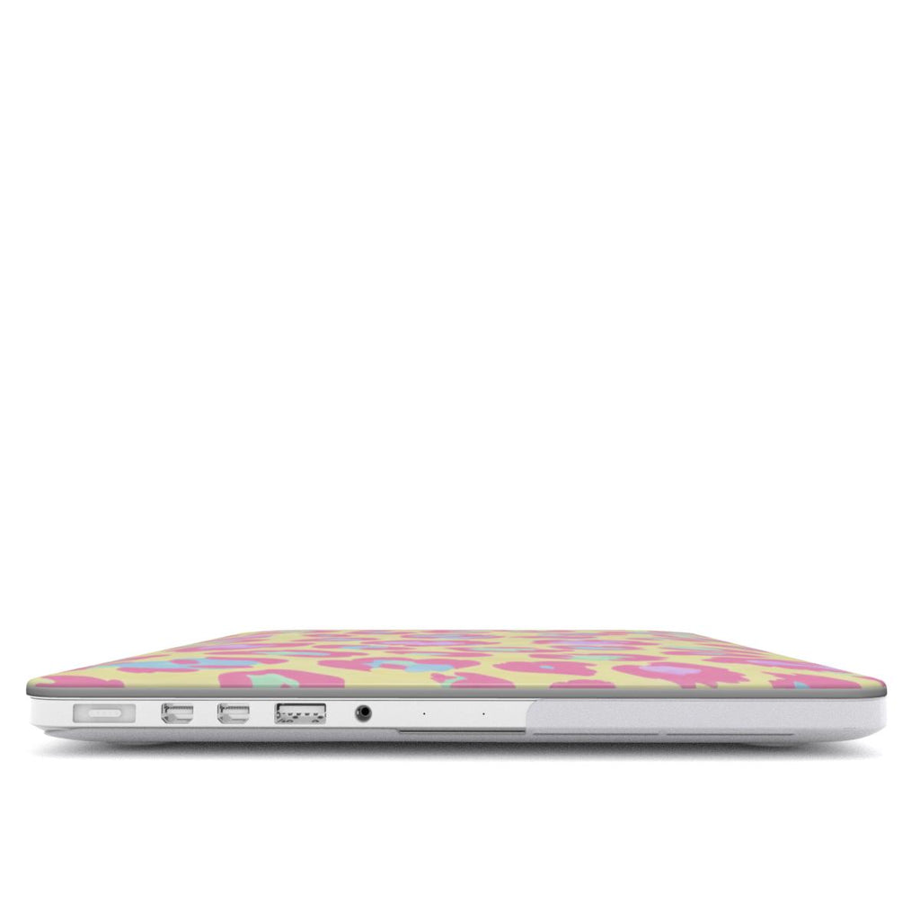 Pastel Leopard MacBook Case | Pink Coral Mint Hardshell Cover for MacBook Air and Pro